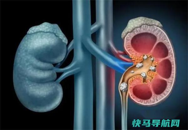 现在才知道,冬瓜不能随便吃?医生:这5类人,建议别凑热闹了 第3张